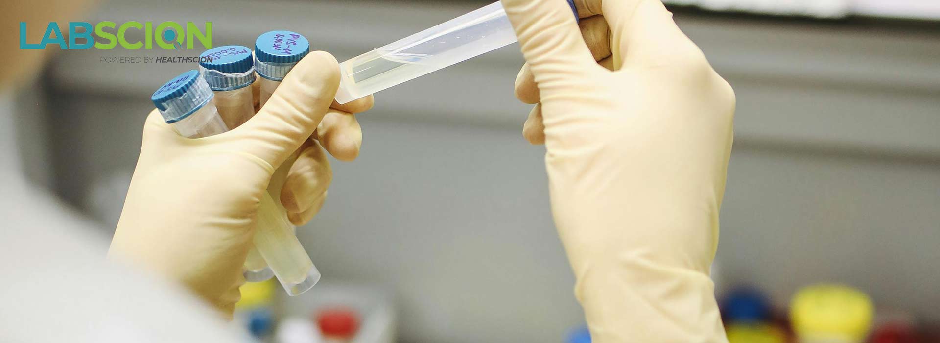 laboratory inventory management system
